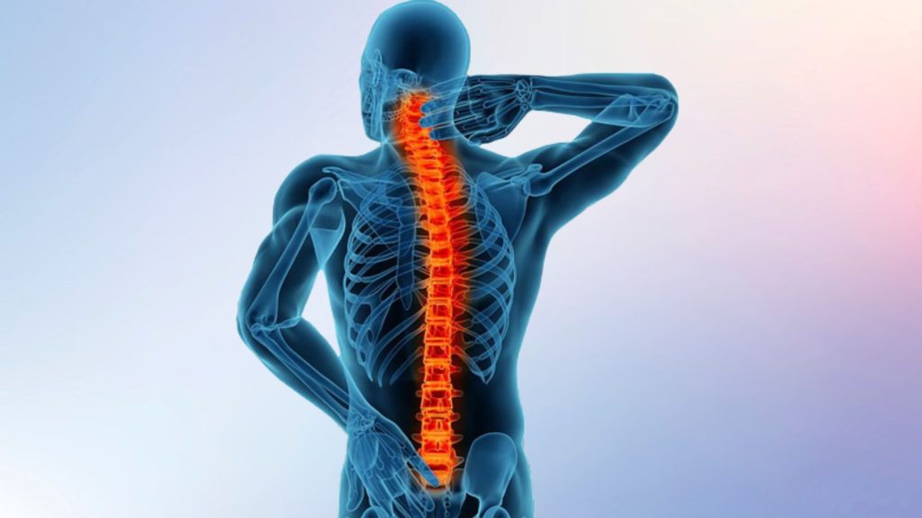 About Spinal Fusion